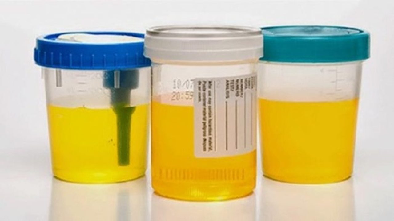 Cara Cek Kehamilan Tanpa Tespek 10 Metode Mudah