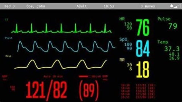 Easy Cara Membaca Layar Monitor Icu Dengan Mudah Vrogue Co